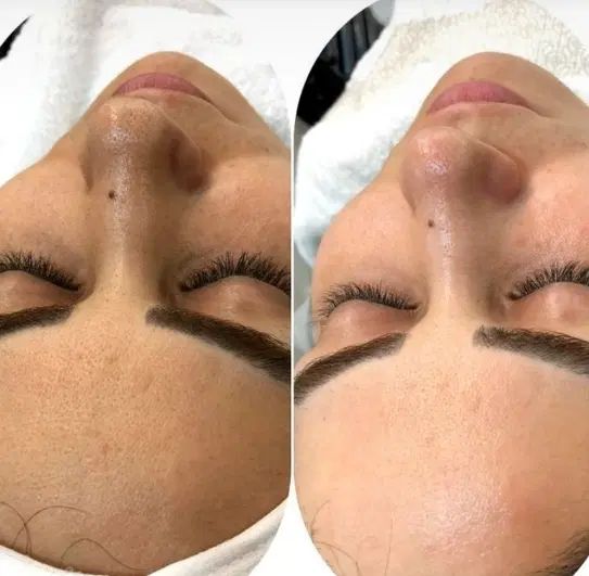 خدمات تخصصی پوست و زیبایی صورت ۵۰٪آف تا فردا|خدمات آرایشگری و زیبایی|مشهد, دانشجو|دیوار