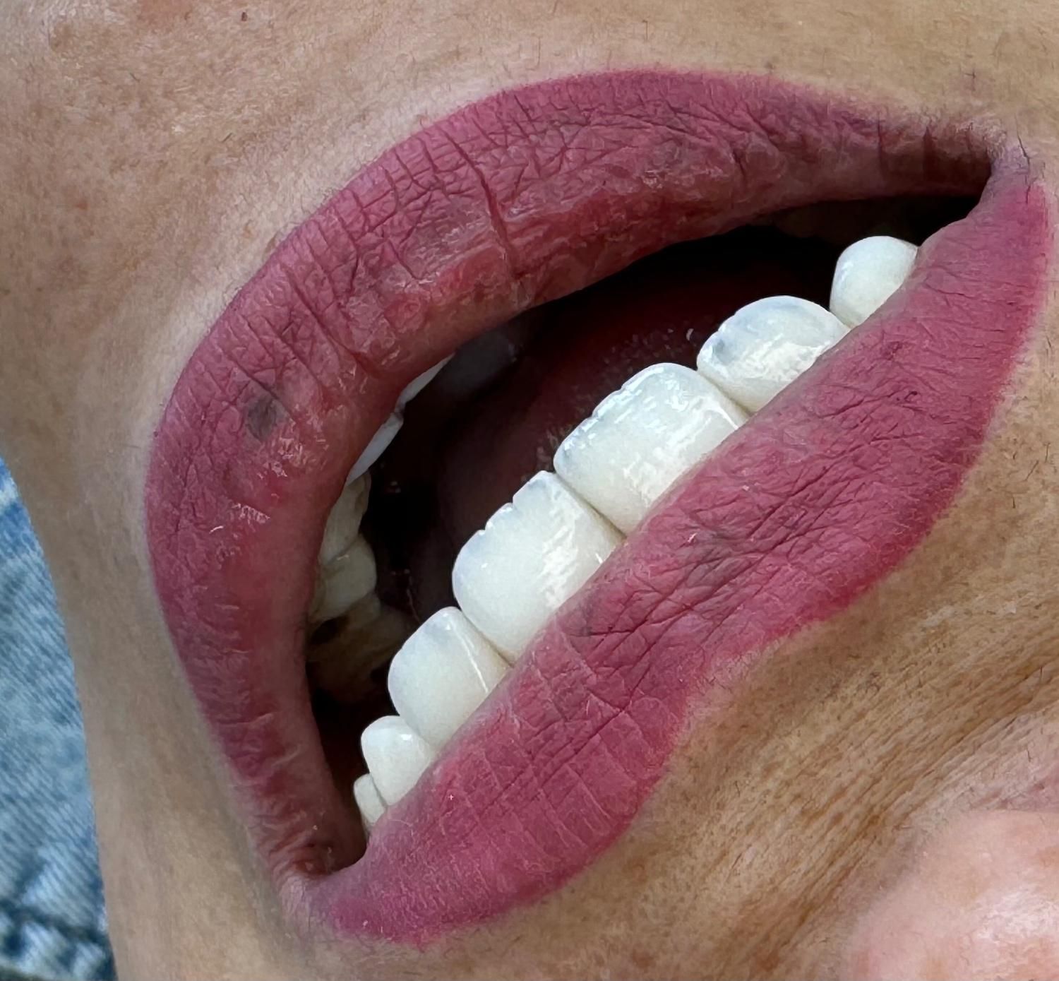 جشنواره دندانپزشکی زیبایی و درمانی|خدمات آرایشگری و زیبایی|تبریز, |دیوار