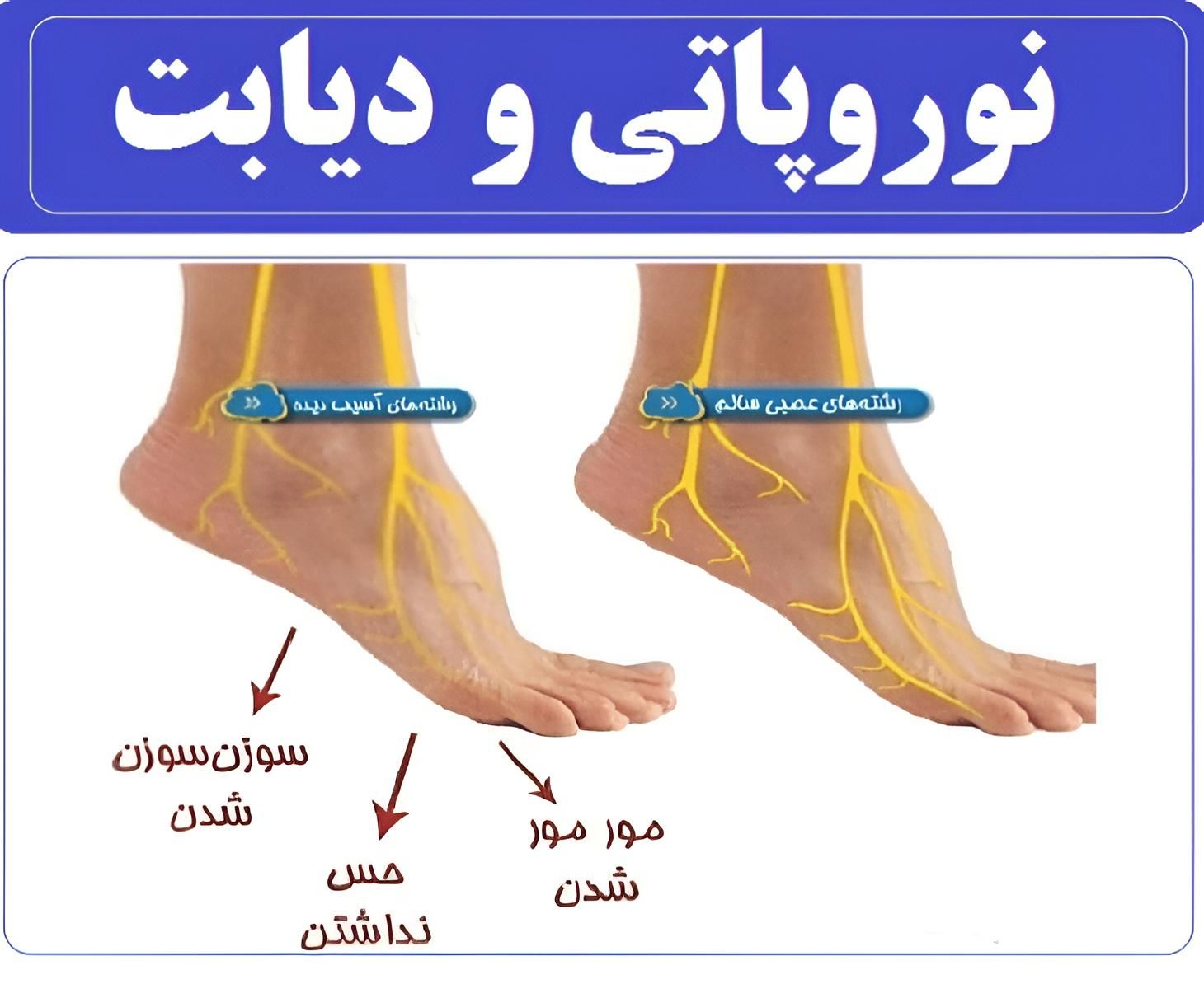 علائم دیابت خاموش|خدمات آرایشگری و زیبایی|اهواز, پردیس|دیوار