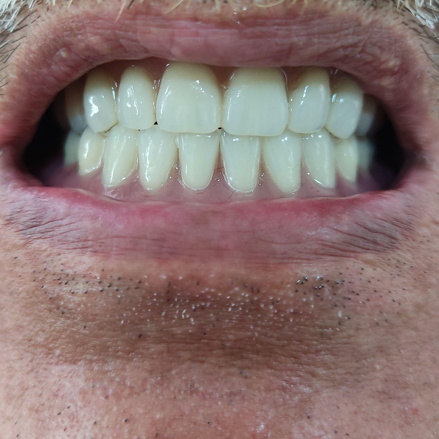 دندانسازی (ساخت دندان مصنوعی تعمیر دندان مصنوعی )|خدمات آرایشگری و زیبایی|تهران, مشیریه|دیوار