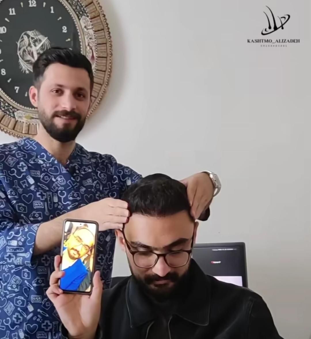 کاشت شیرازی موی سر و ابرو در ارومیه به مدت کوتاه|خدمات آرایشگری و زیبایی|ارومیه, |دیوار