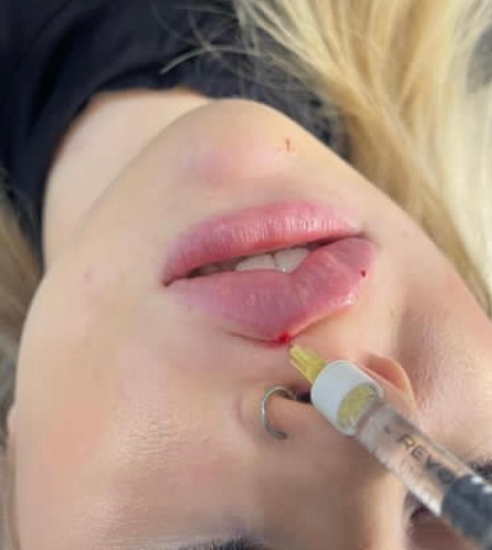 کلینیک پوست و مو|خدمات آرایشگری و زیبایی|تهران, ستارخان|دیوار