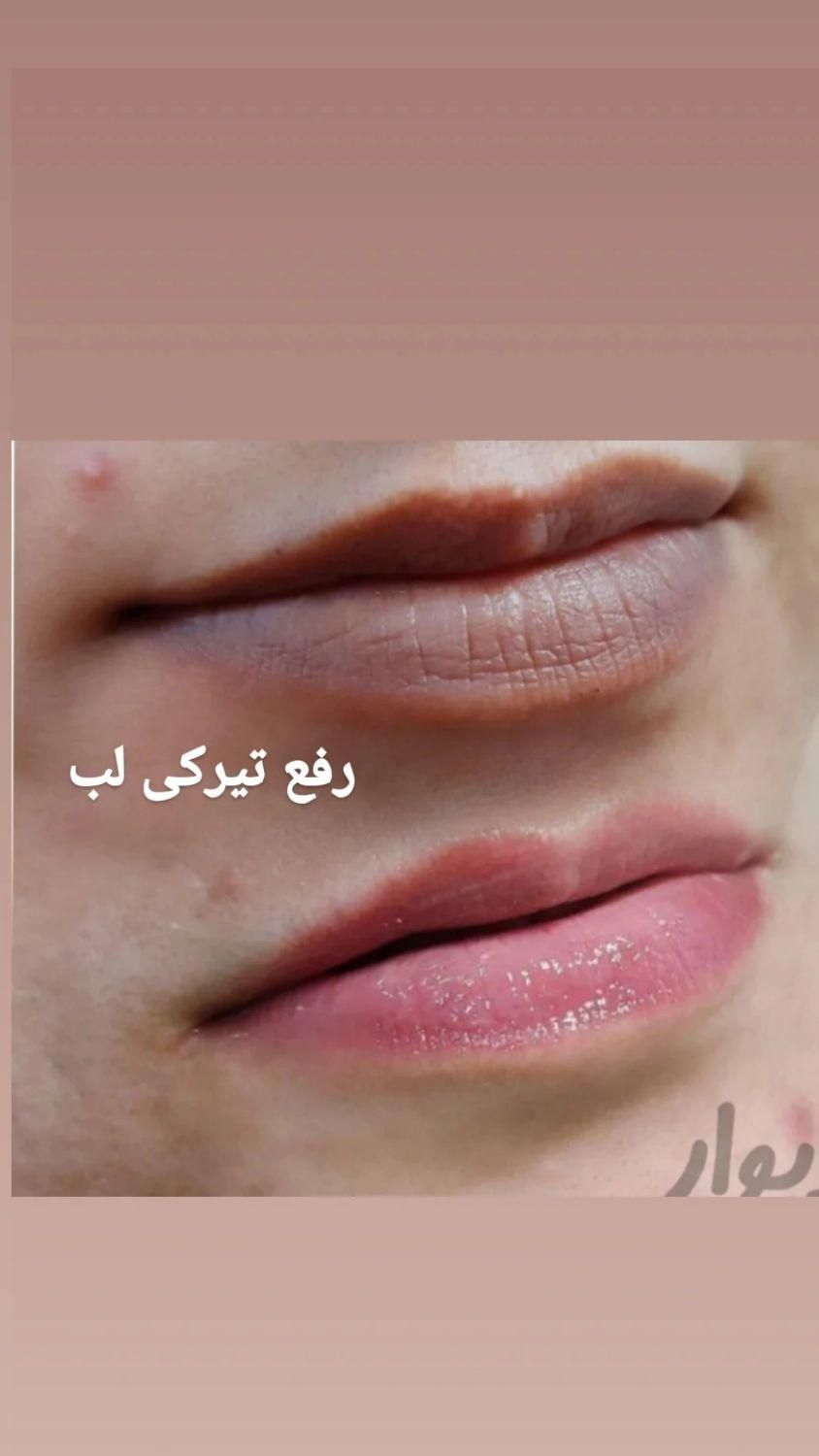 سالن تخصصی میکروپیگمنتیشن و زیبایی|خدمات آرایشگری و زیبایی|زابل, |دیوار