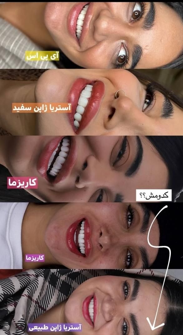 خدمات دندانپزشکی لمینت دندان کامپوزیت ودرمانی|خدمات آرایشگری و زیبایی|تهران, فلسطین (میدان انقلاب)|دیوار