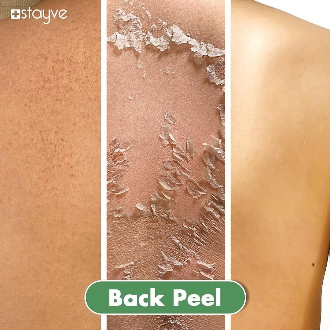 آموزش تکنیک پوست ماری|خدمات آموزشی|تهران, امیریه|دیوار