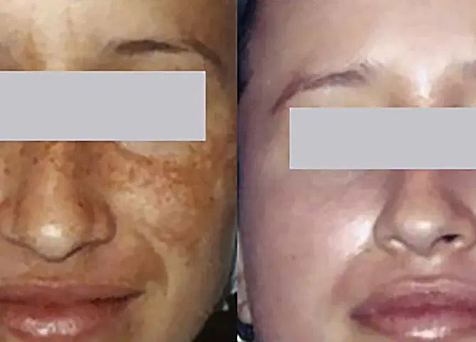 انواع روغن گیاهی اصل ضمانتی برا زیبایی پوست ورشدمو|آرایشی، بهداشتی، درمانی|سراوان, |دیوار
