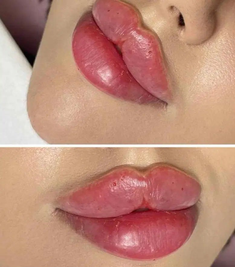 تخفیفات ژل و بوتاکس ومزوتراپی (آموزش۴ونیم)|خدمات آرایشگری و زیبایی|خرم‌آباد, |دیوار