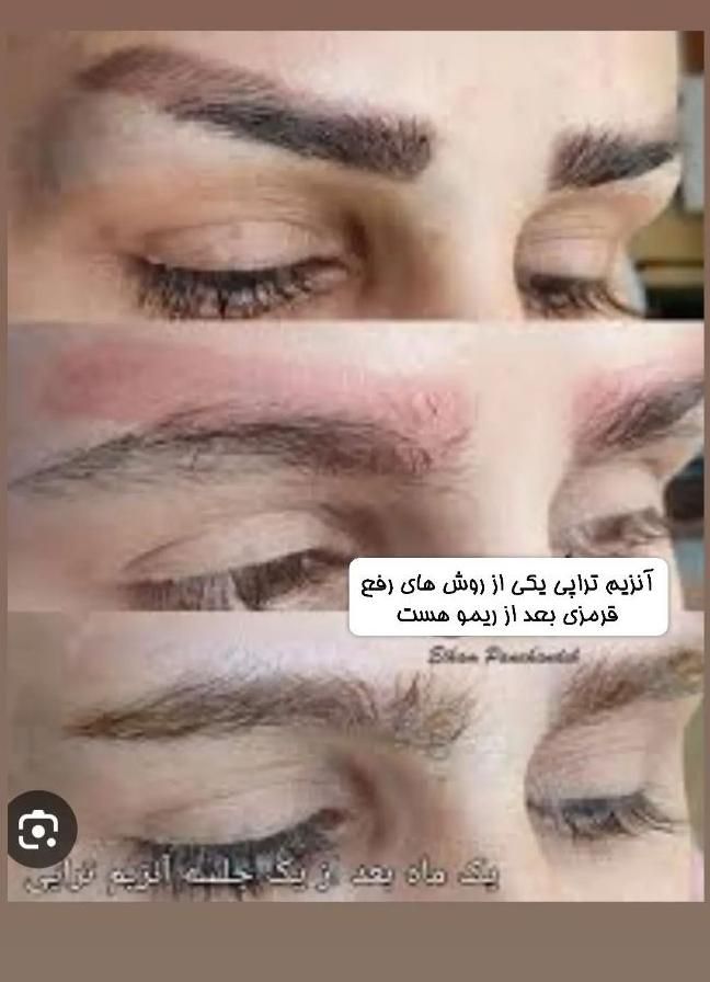 ریموو تک جلسه ای با رژووی پلاس خفن ابرو خطچشم|خدمات آرایشگری و زیبایی|کرمان, |دیوار