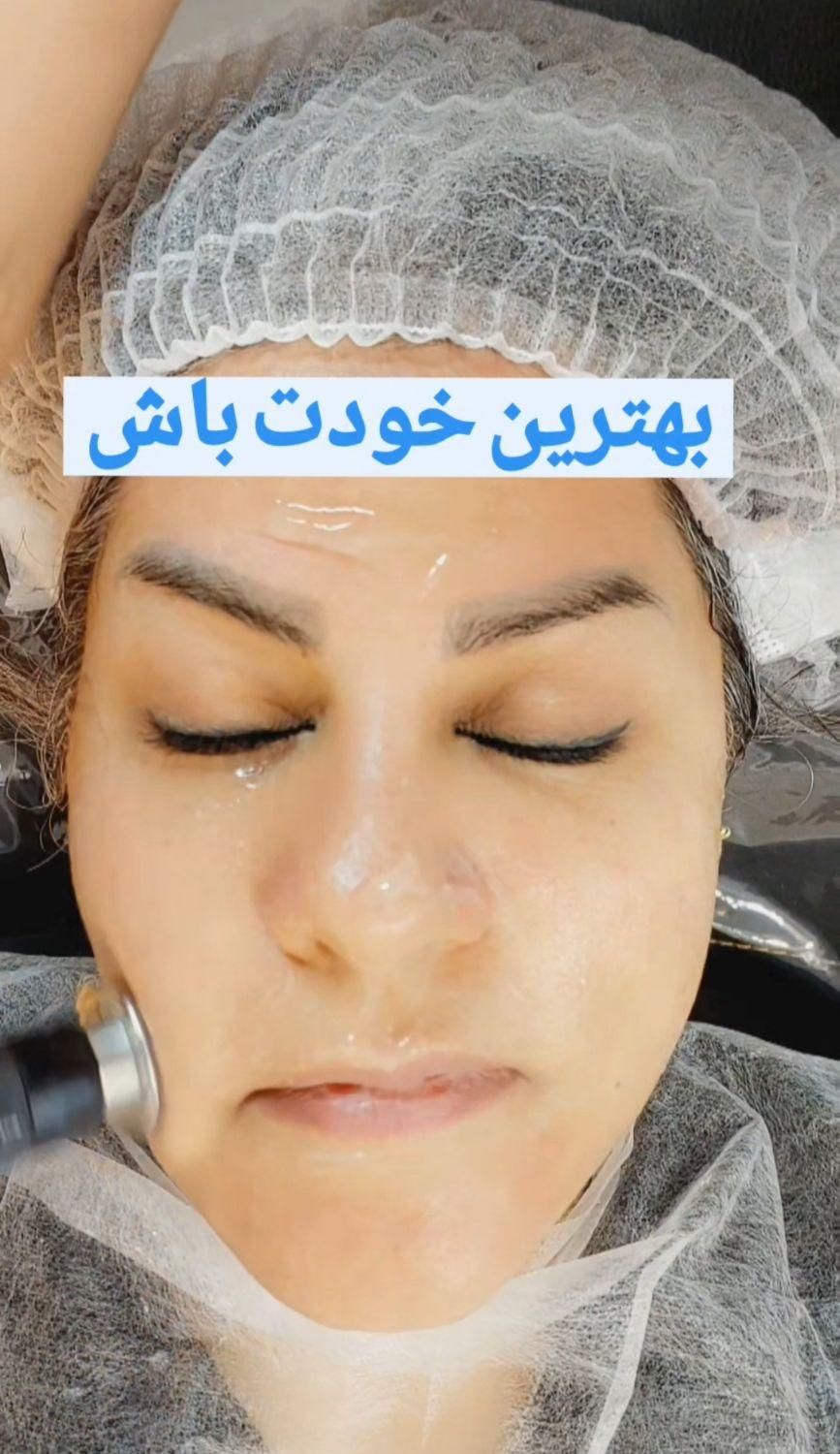 فیشال و پاکسازی پوست|خدمات آرایشگری و زیبایی|اصفهان, فجر|دیوار