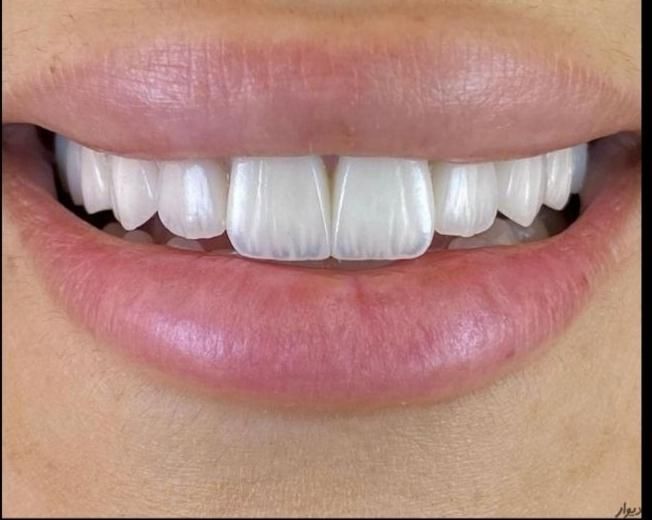 دندانپزشک فارغ التحصیل دارای پروانه طبابت|استخدام درمانی، زیبایی، بهداشتی|تبریز, |دیوار