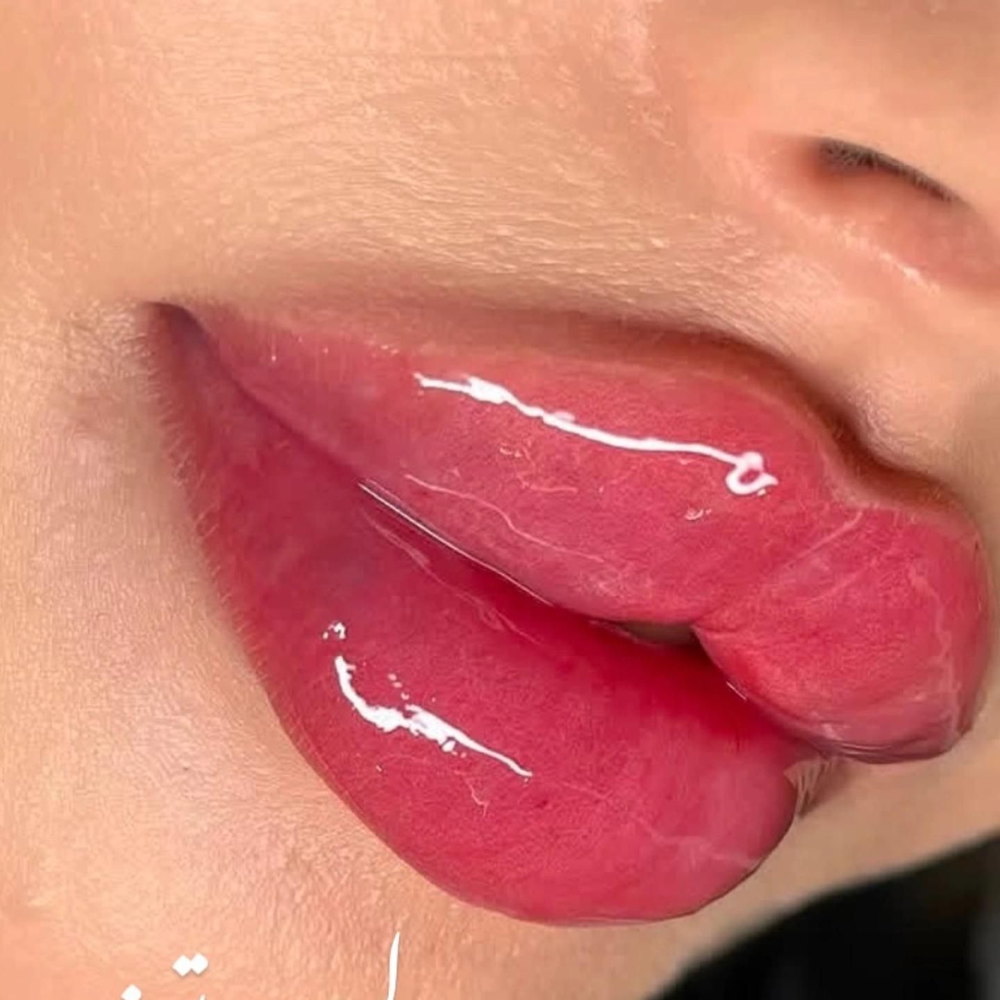 تزریق ژل لب و بوتاکس|خدمات آرایشگری و زیبایی|شیراز, شهرک مهدی‌آباد|دیوار