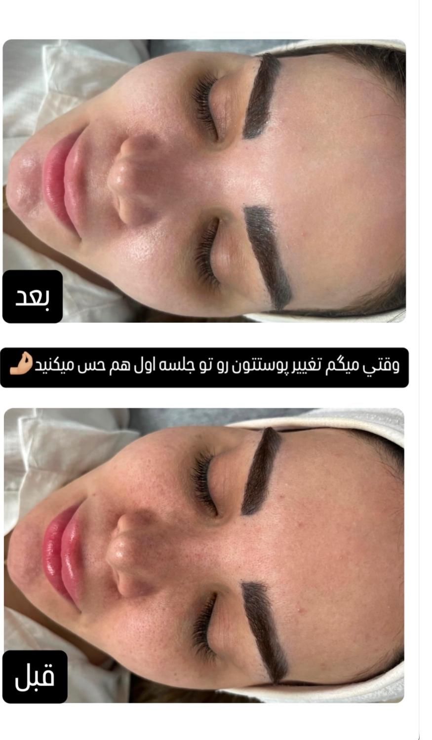 آموزش پاکسازی پوست،فشیال|خدمات آموزشی|اراک, |دیوار