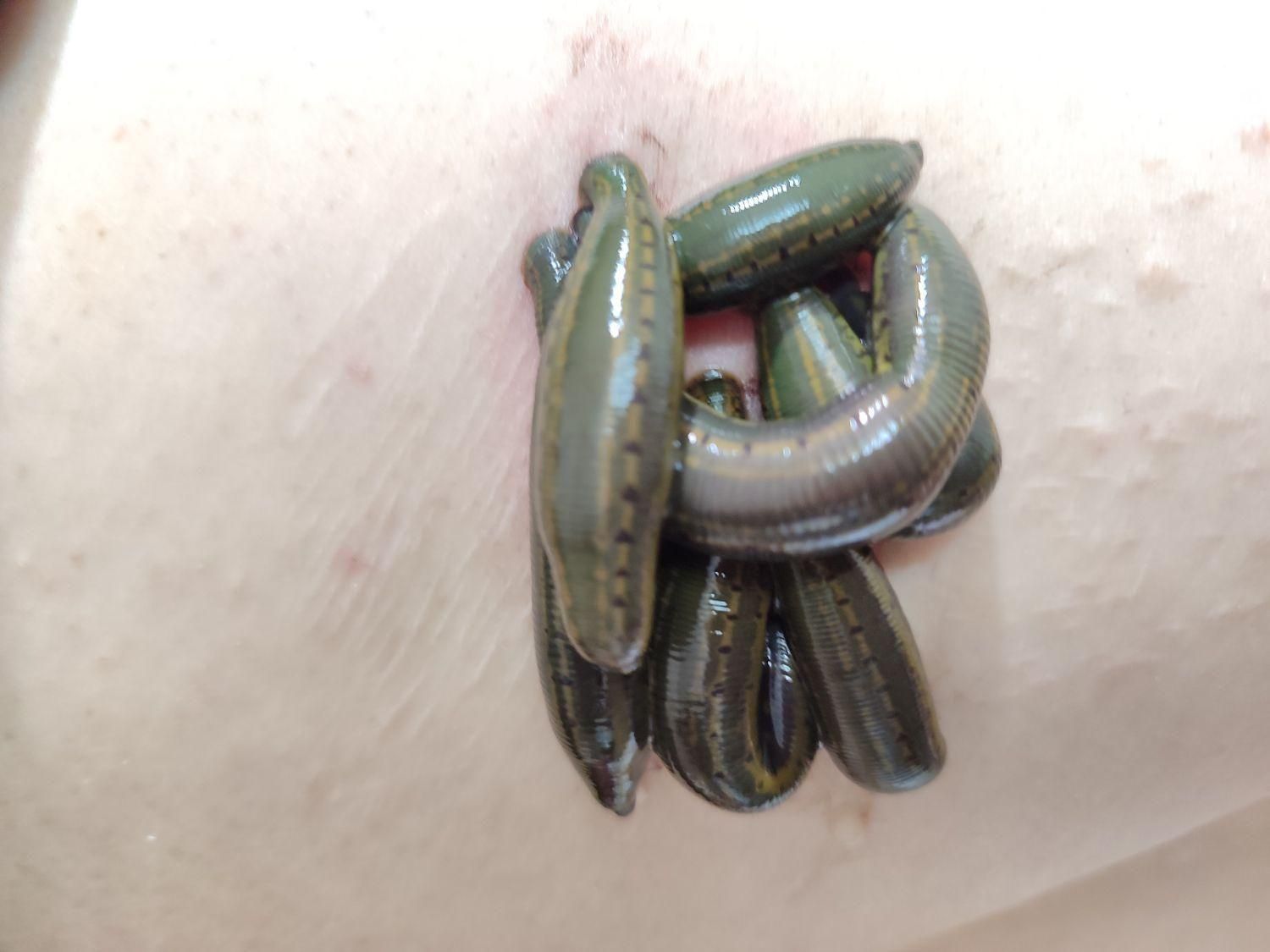 زالودرمانی / حجامت/ بادکش درمانگرآقاوخانم باسابقه|خدمات آرایشگری و زیبایی|مشهد, امام رضا (ع)|دیوار