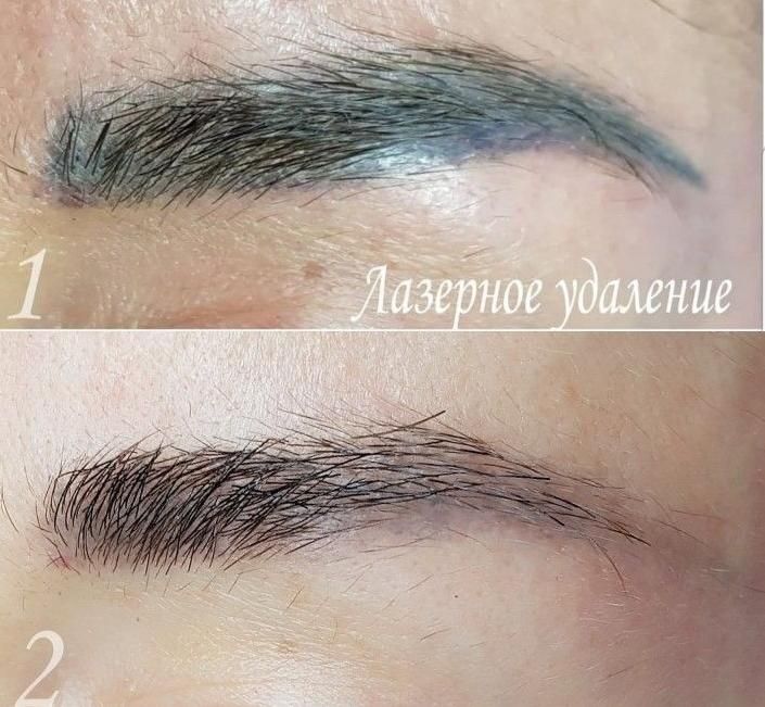 ریمو ابرو به صورت تخصصی و حرفه ایی|خدمات آرایشگری و زیبایی|هشتگرد, هشتگرد قدیم|دیوار