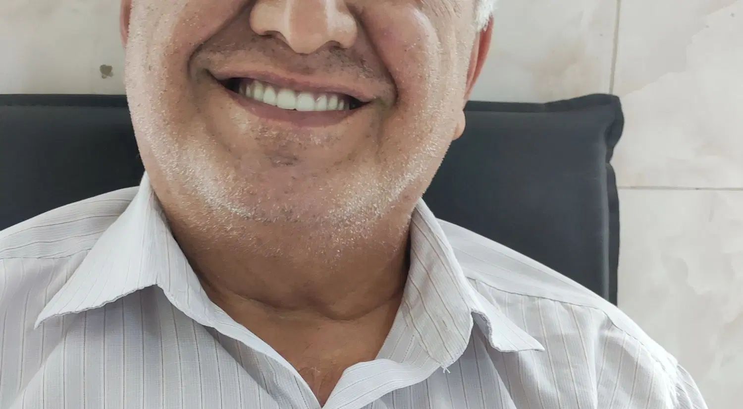 ساخت انواع پروتز های دندان مصنوعی|خدمات آرایشگری و زیبایی|کرج, برغان|دیوار