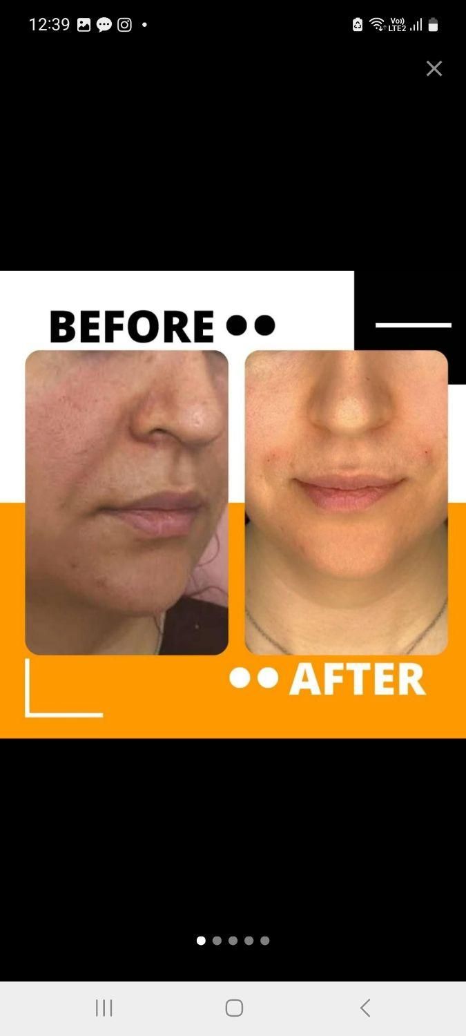 مرکز لیزر و زیبایی دکتر فروغ احمدی پور|خدمات آرایشگری و زیبایی|پردیس, فاز ۴|دیوار