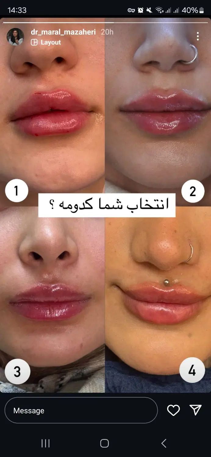 نیاز به لیزر بهمراه دستگاه لیزر یا فیشیالیست|استخدام درمانی، زیبایی، بهداشتی|همدان, |دیوار