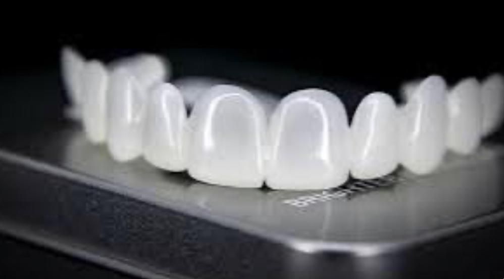 لمینت متحرک دندان|آرایشی، بهداشتی، درمانی|سنندج, |دیوار