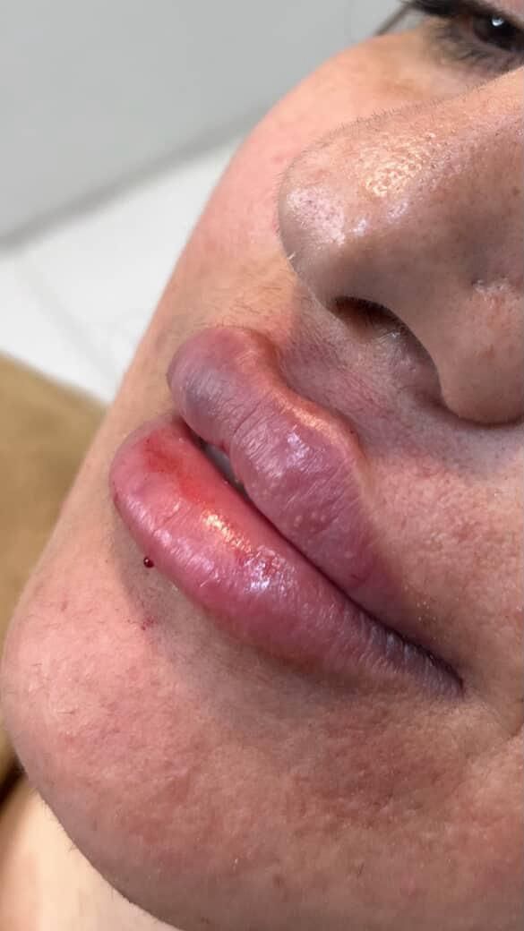 جشنواره ۳۰٪ تخفیفات ژل لب/فیلر صورت/بوتاکس/مزوژل|خدمات آرایشگری و زیبایی|مشهد, هنرستان|دیوار