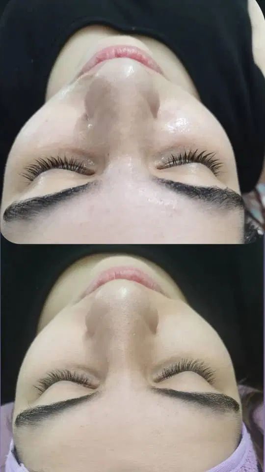 پاکسازی حرفه‌ای پوست با فیشال کلاسیک|خدمات آرایشگری و زیبایی|رشت, رشتیان|دیوار