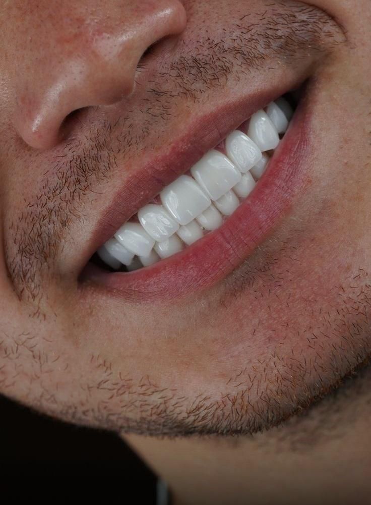 دندان ، دندانپزشکی ، لمینت ، کامپوزیت ، ایمپلنت|خدمات آرایشگری و زیبایی|مشهد, دانشجو|دیوار