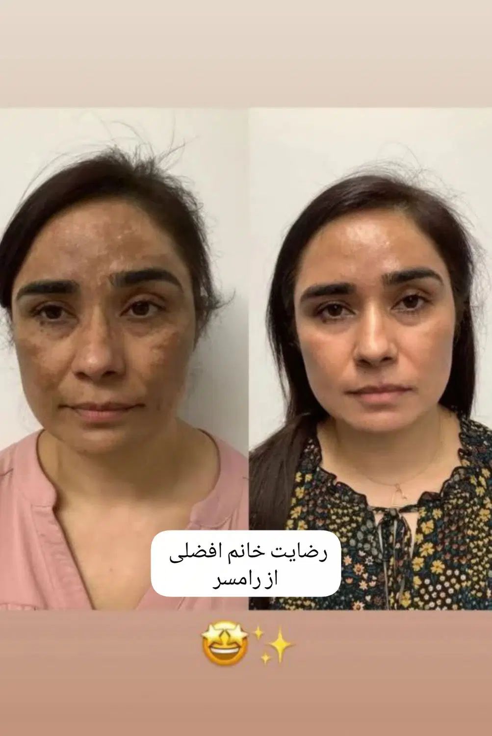 زیبایی پوستت رو به ما بسپر|آرایشی، بهداشتی، درمانی|تهران, سلسبیل شمالی|دیوار