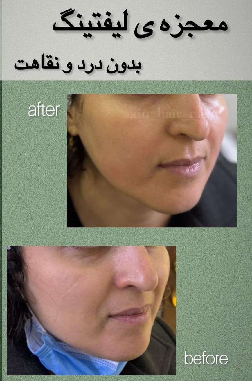 مرکز مراقبت پوست مو لاغری رشت|خدمات آرایشگری و زیبایی|رشت, گلباغ نماز|دیوار