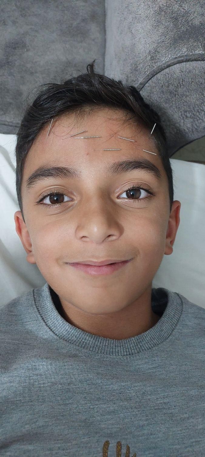 ماساژ..طب سوزنی.|خدمات آرایشگری و زیبایی|نیشابور, شهرک جانبازان|دیوار