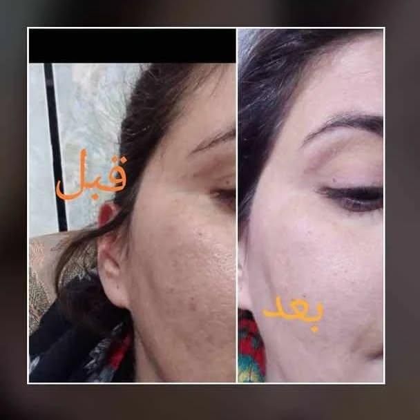 کرم وی آی پی (VIP) اصل|آرایشی، بهداشتی، درمانی|تهران, زعفرانیه|دیوار