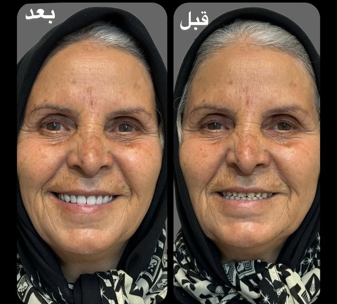 مرکز ساخت تخصصی دندان مصنوعی،دندانسازی باضمانت|خدمات آرایشگری و زیبایی|یزد, |دیوار