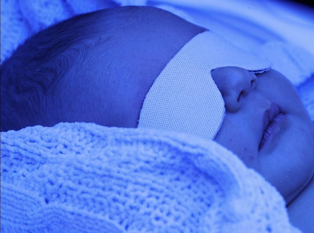 اجاره دستگاه زردی فتوتراپی اقتصادی|پزشکی|هشتگرد, هشتگرد قدیم|دیوار