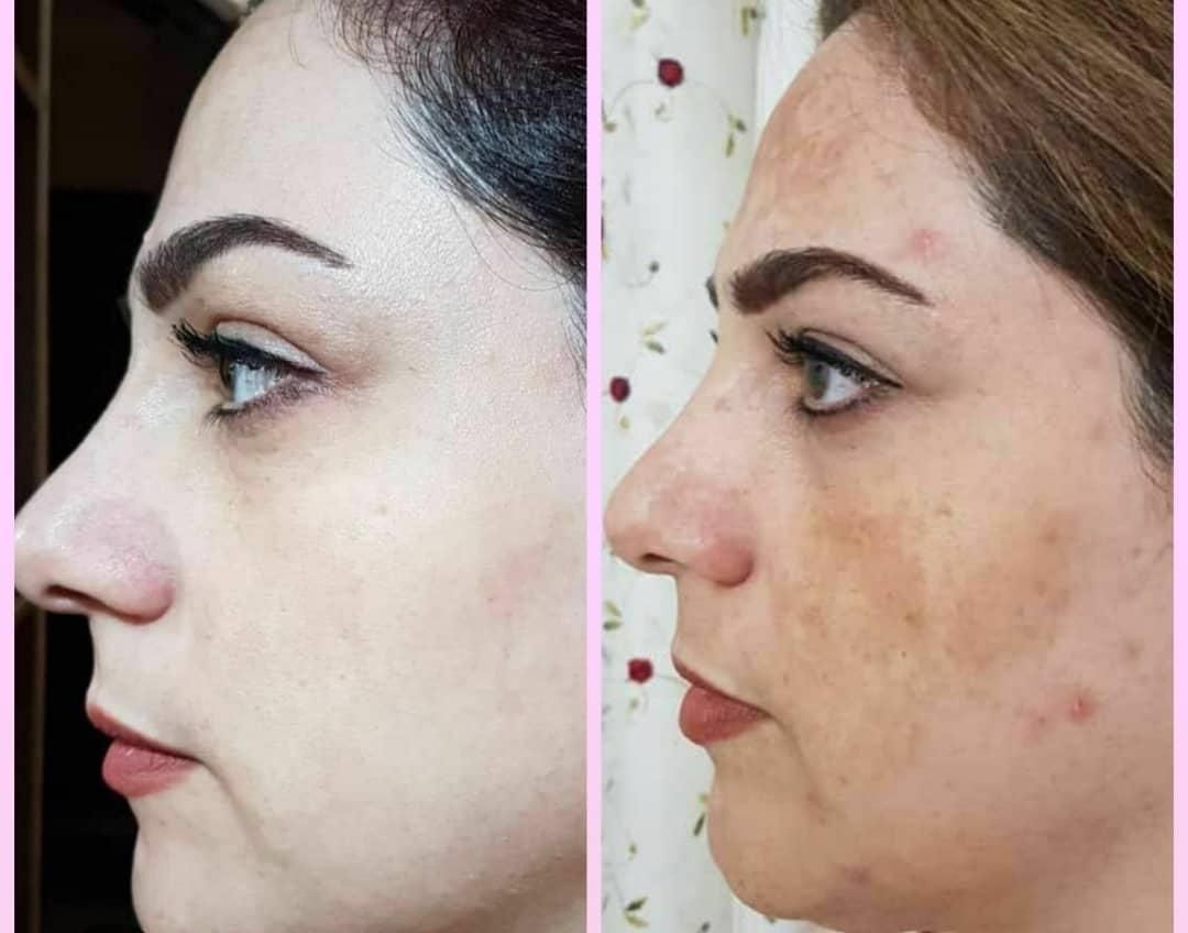 کرم معجزه اصلی تضمینی جوابدهی سریع|آرایشی، بهداشتی، درمانی|شیراز, کوشک میدان|دیوار