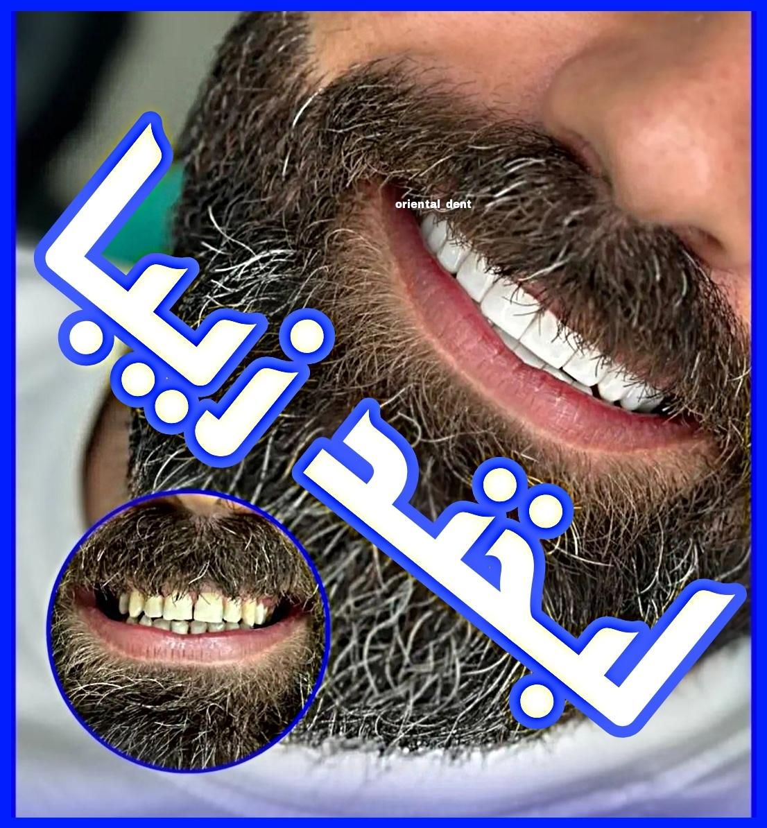 ایمپلنت عصبکشی روکش کامپوزیت ترمیم پوسیدگی دندان|خدمات آرایشگری و زیبایی|تهران, میدان ولیعصر|دیوار