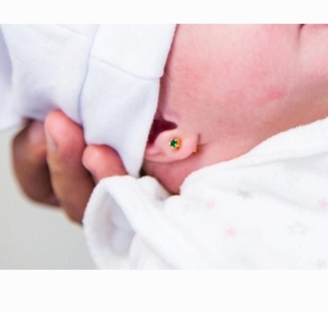 سوراخ کردن گوش توسط پزشک|خدمات آرایشگری و زیبایی|زنجان, |دیوار