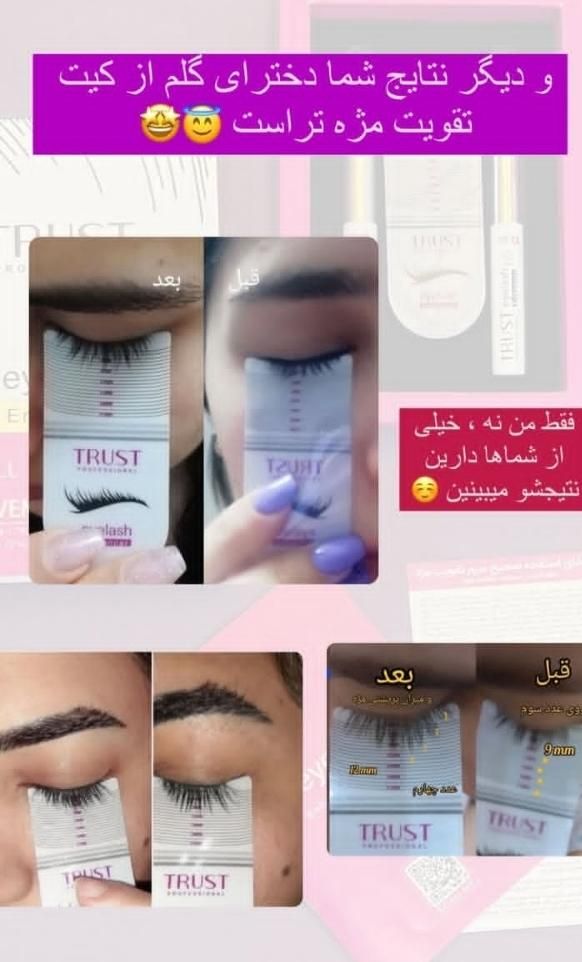 سرم مژه معجزه گر|آرایشی، بهداشتی، درمانی|اصفهان, گلستان|دیوار