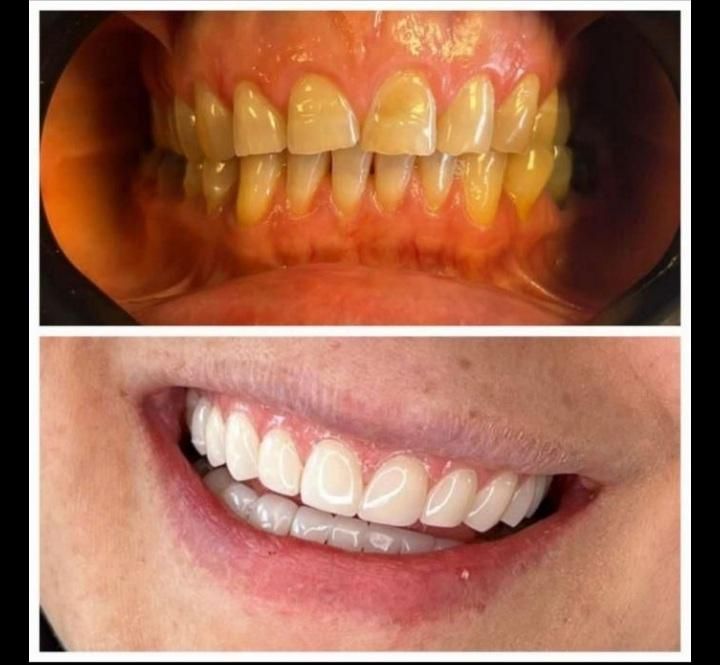 ارائه خدمات زیبایی و درمانی دندانپزشکی|خدمات آرایشگری و زیبایی|کرمانشاه, |دیوار