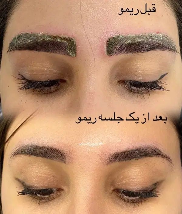 ریموو تضمینی،میکروبلیدینگ،خط چشم و شیدینگ|خدمات آرایشگری و زیبایی|کرمانشاه, |دیوار