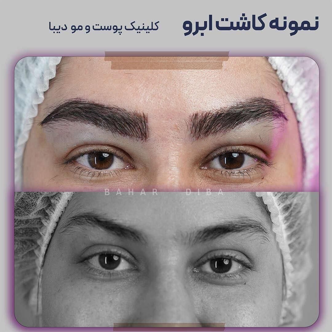 (+فیلم) کلینیک کاشت مو، ابرو و ریش|خدمات آرایشگری و زیبایی|تهران, صادقیه|دیوار