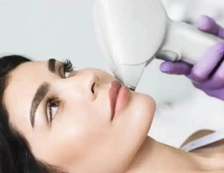 لیزر موهای زائد با دستگاه دایود ۲۰۲۴تضمینی|خدمات آرایشگری و زیبایی|فردیس, فردیس|دیوار