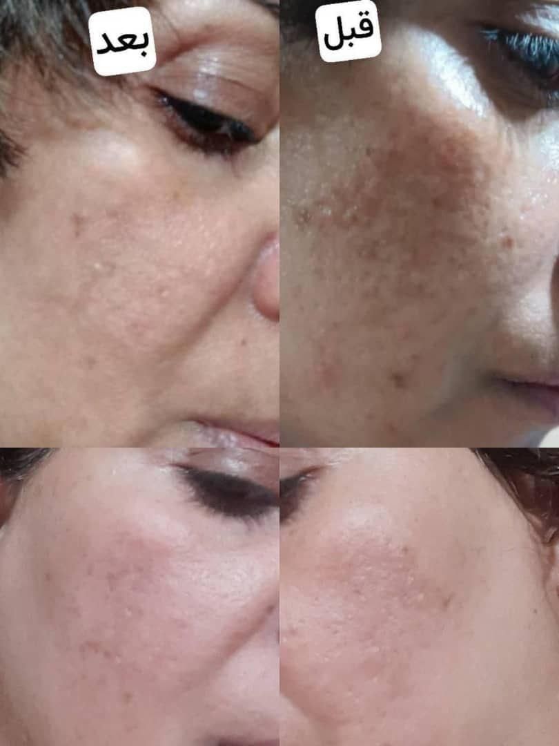 پاکسازی پوست فروش محصولات آرایشی و بهداشتی صورت...|خدمات آرایشگری و زیبایی|گلبهار, |دیوار