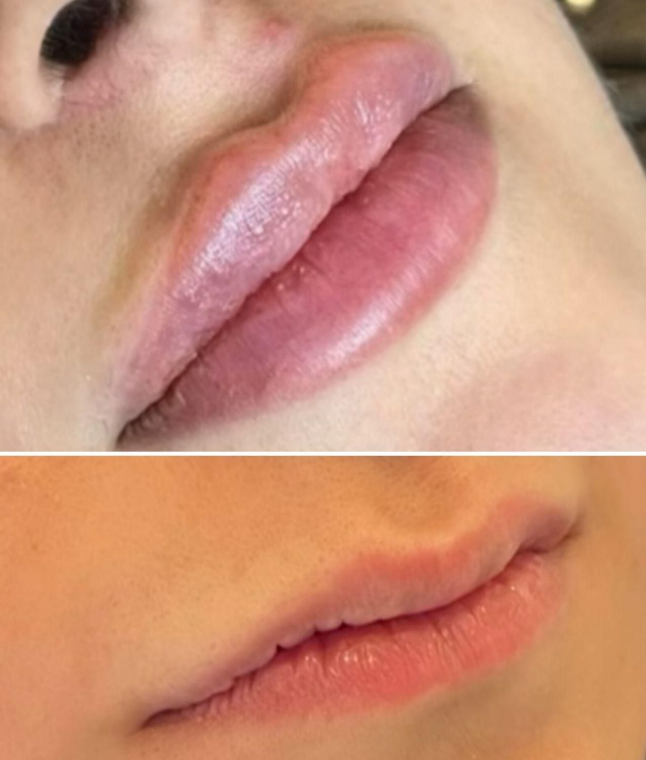 تخفیفات زیبایی و عملهای جراحی|خدمات آرایشگری و زیبایی|دوگنبدان, |دیوار