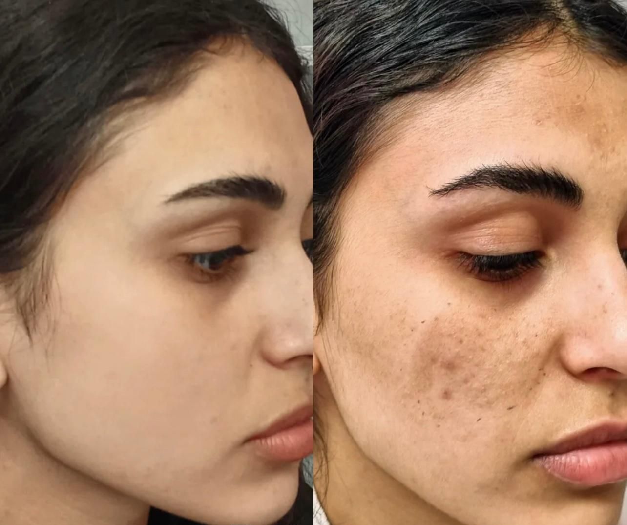 تخفیفات۵۰ درصدی ژل،بوتاکس،انزیم کیلینیک هستی|خدمات آرایشگری و زیبایی|کرمانشاه, |دیوار