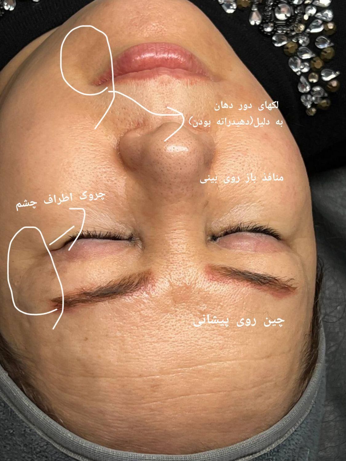 جشنواره تخفیفی فیشال تخصصی صورت|خدمات آرایشگری و زیبایی|مشهد, هفده شهریور|دیوار