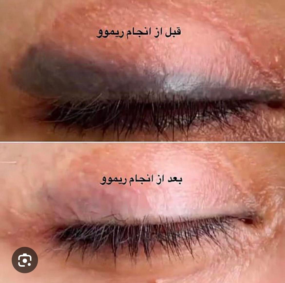 اجرا و حذف تتو|خدمات آرایشگری و زیبایی|شیراز, مسلم|دیوار