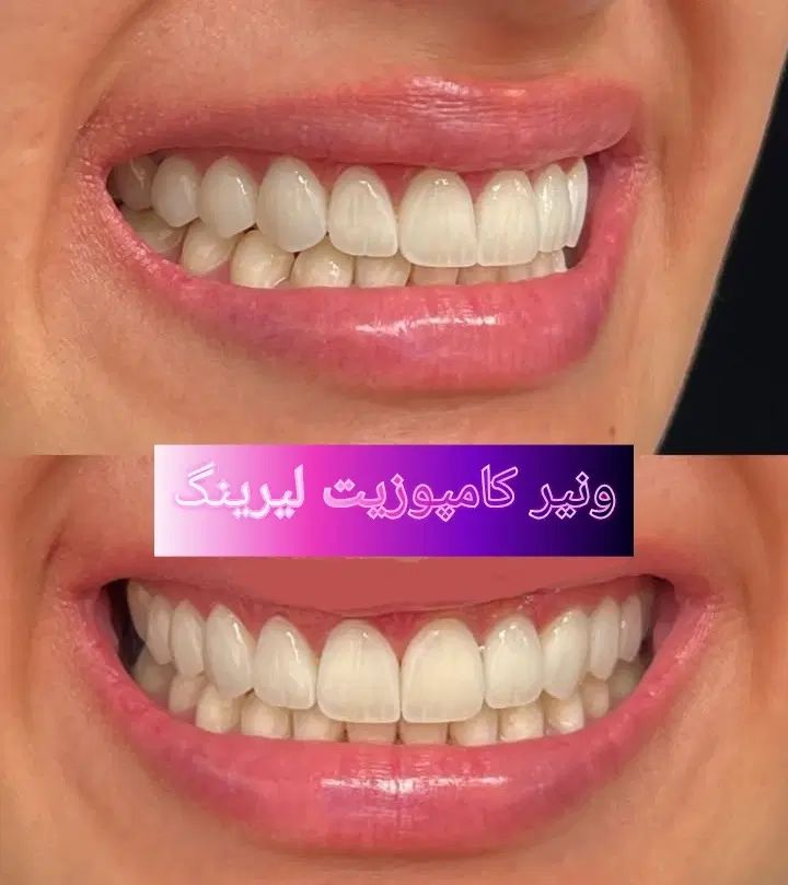 دندانپزشکی لبخند مرواریدی|خدمات آرایشگری و زیبایی|تهران, سوهانک|دیوار