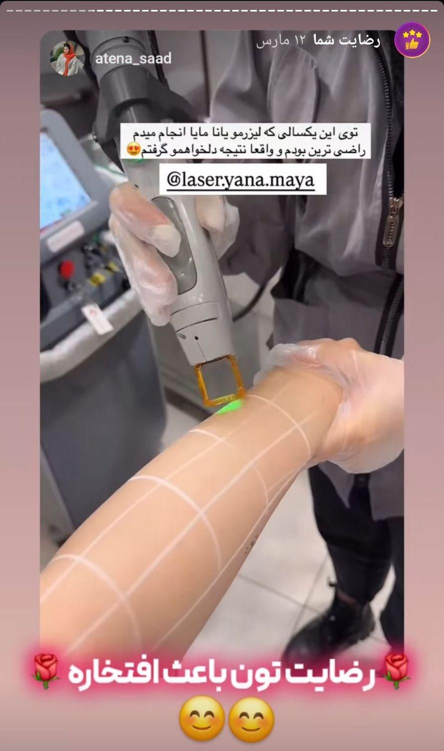 ۳۵۰،۰۰۰ت اعتبارهدیه باشگاه یانا و مایا(لیزر کندلا)|خدمات آرایشگری و زیبایی|شوش, |دیوار