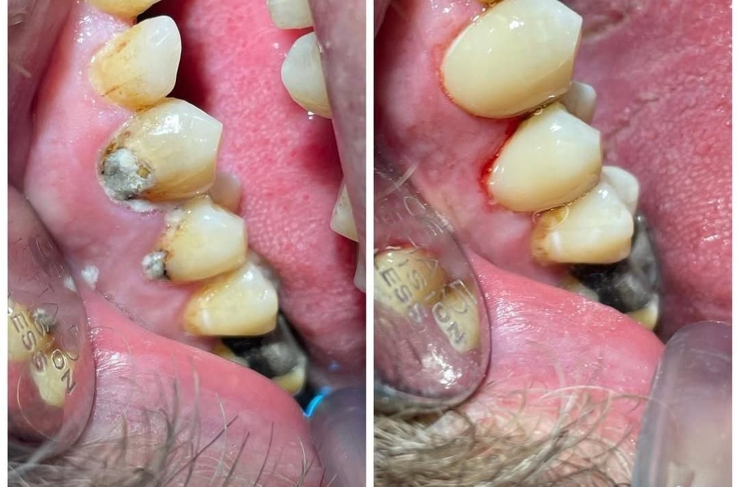 خدمات درمانی دندان پزشکی|خدمات آرایشگری و زیبایی|قم, چهار مردان|دیوار