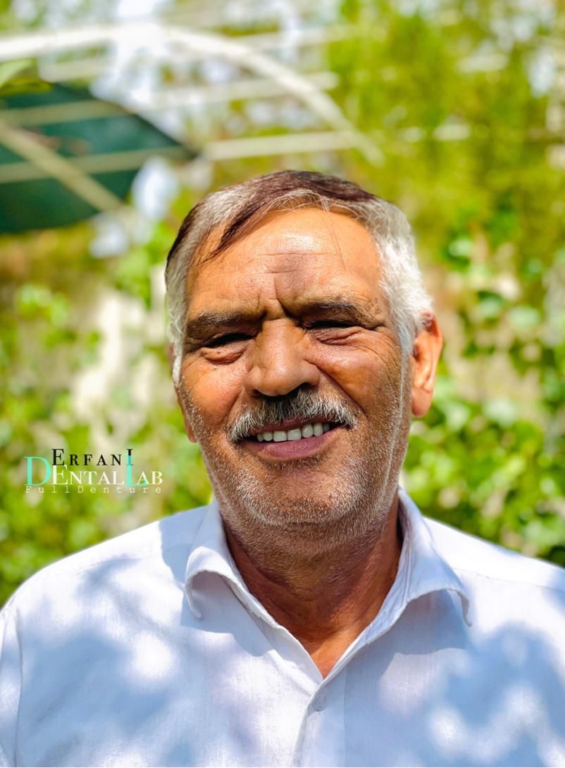 دندان اختصاصی مناسب با چهره شما|خدمات آرایشگری و زیبایی|طرقبه, |دیوار