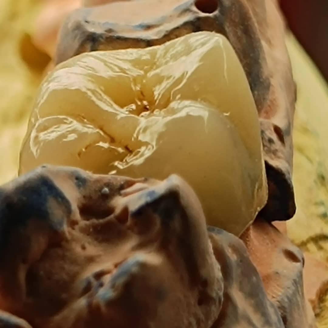 لابراتوار پروتزهای دندانی ثابت|پزشکی|نسیمشهر, |دیوار