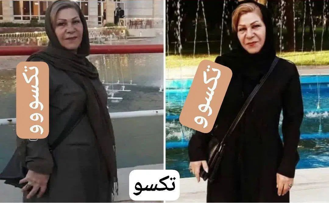 پاکسازی کبد و اصلاح مزاج لاغری پوست مو چاقی صورت|آرایشی، بهداشتی، درمانی|فردیس, شهرک ۱۱۰|دیوار
